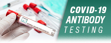COVID-19 IgG Antibody Testing
